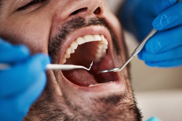 Best Same-Day Emergency Dental Services in Bridgewater, VA