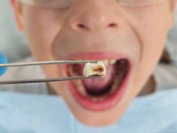 Best Cosmetic Emergency Dentistry in Bridgewater, VA